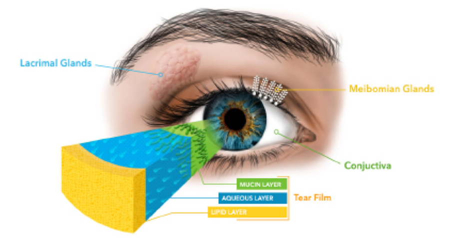 dry eye diagram, lacrimal glands, meibomian glands, tear film layers